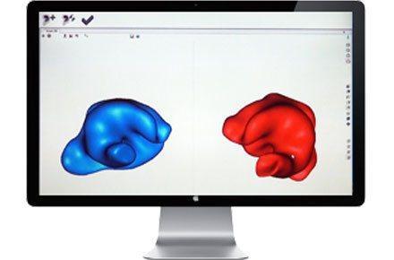 Beispiel eines 3D eingescannten Abdruckes, der linke in blau und der rechte in rot. 3D-Scan der Ohrabdrücke für die Herstellung einer Otoplastik