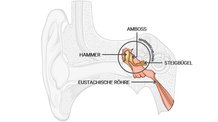 Das Mittelohr empfängt den vom Trommelfell übertragenen Schall, verstärkt ihn und leitet ihn dann an das Innenohr weiter
